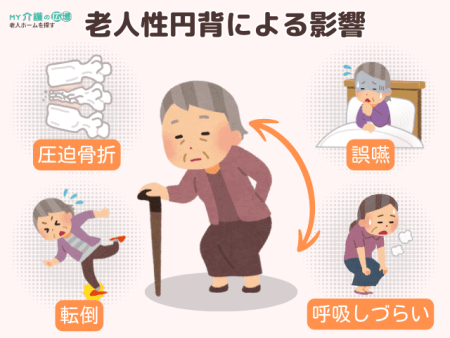 老人性円背による影響